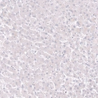 Immunohistochemical staining of human liver shows no positivity in hepatocytes as expected.