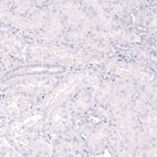 Immunohistochemical staining of human kidney shows no positivity in cells in tubules as expected.