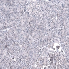Immunohistochemical staining of human pancreas shows no positivity in exocrine glandular cells as expected.
