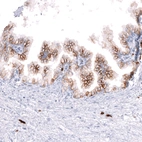 Immunohistochemical staining of human prostate shows strong membranous positivity in glandular cells.