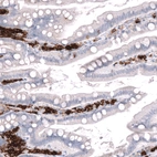 Immunohistochemical staining of human duodenum shows strong membranous positivity in lymphoid cells.