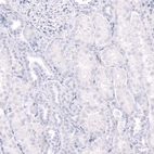 Immunohistochemical staining of human kidney shows no positivity in cells in tubules as expected.