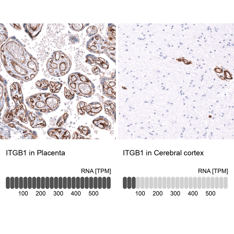 Anti-ITGB1 Antibody