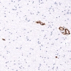 Immunohistochemical staining of human cerebral cortex shows strong membranous positivity in endothelial cells.
