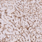 Immunohistochemical staining of human liver shows strong positivity in sinusoids.