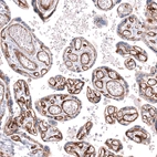 Immunohistochemical staining of human placenta shows strong membranous positivity in endothelial cells.