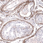 Immunohistochemical staining of human testis shows strong membranous positivity in peritubular myoid cells.