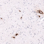 Immunohistochemical staining of human cerebral cortex shows strong positivity in endothelial cells.