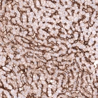 Immunohistochemical staining of human liver shows strong positivity in sinusoids, as well as weaker membranous positivity in hepatocytes.