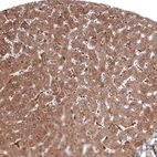 Immunohistochemical staining of human liver shows moderate cytoplasmic positivity in hepatocytes.