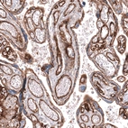 Immunohistochemical staining of human placenta shows strong membranous positivity in endothelial cells.