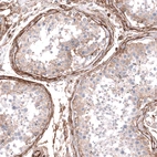 Immunohistochemical staining of human testis shows strong membranous positivity in peritubular myoid cells.
