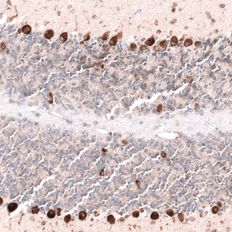 Anti-PTN Antibody
