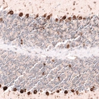 Anti-PTN Antibody