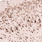 Immunohistochemical staining of mouse cerebral cortex shows moderate to strong cytoplasmic positivity in neurons.