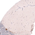 Immunohistochemical staining of human cerebellum shows strong cytoplasmic positivity in Purkinje cell.