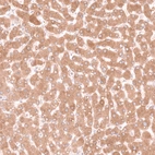 Immunohistochemical staining of human liver shows moderate cytoplasmic positivity in hepatocytes.