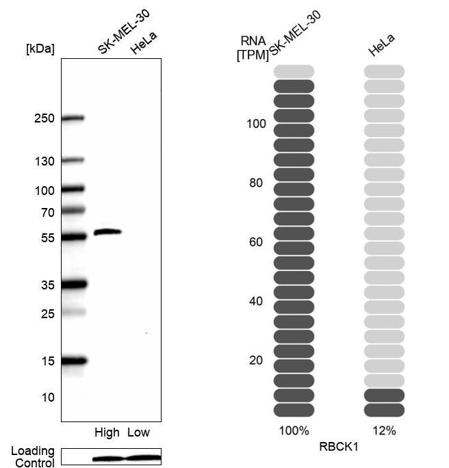 Anti-RBCK1 Antibody
