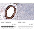 Anti-ABCB5 Antibody