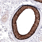 Immunohistochemical staining of human epididymis shows strong membranous positivity in glandular cells.