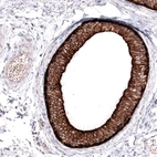 Immunohistochemical staining of human epididymis shows strong membranous positivity in glandular cells.