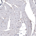 Immunohistochemical staining of human skeletal muscle shows no positivity in myocytes as expected.