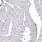 Immunohistochemical staining of human skeletal muscle shows no positivity in myocytes as expected.