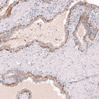 Immunohistochemical staining of human prostate shows moderate membranous positivity in the basal layer of glandular cells.