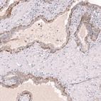 Immunohistochemical staining of human prostate shows moderate membranous positivity in the basal layer of glandular cells.
