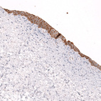Immunohistochemical staining of human urinary bladder shows moderate membranous positivity in urothelial cells.