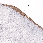 Immunohistochemical staining of human urinary bladder shows moderate membranous positivity in urothelial cells.