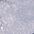 Immunohistochemical staining of human tonsil shows no positivity in lymphoid cells as expected.