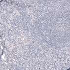 Immunohistochemical staining of human tonsil shows no positivity in lymphoid cells as expected.