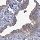 Immunohistochemical staining of human fallopian tube shows strong cytoplasmic positivity in glandular cells.