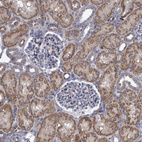 Immunohistochemical staining of human kidney shows strong cytoplasmic positivity in cells in tubules.