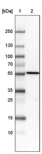 Lane 1: Marker [kDa]_br/_Lane 2:Human cell line U-251 MG