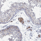 Immunohistochemical staining of human testis shows strong cytoplasmic positivity in Leydig cells.