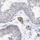 Immunohistochemical staining of human testis shows strong cytoplasmic positivity in Leydig cells.