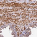 Immunohistochemical staining of human prostate shows strong cytoplasmic positivity in smooth muscle cells.