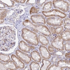 Immunohistochemical staining of human kidney shows moderate cytoplasmic granular positivity in cells in tubules.