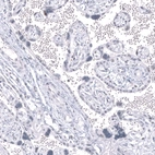 Immunohistochemical staining of human placenta shows no positivity in trophoblastic cells as expected.