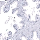 Immunohistochemical staining of human prostate shows no positivity in glandular cells as expected.