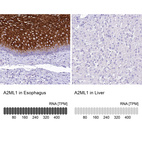 Anti-A2ML1 Antibody