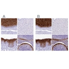 Immunohistochemical staining of human esophagus, liver, skin and tonsil using Anti-A2ML1 antibody HPA038847 (A) shows similar protein distribution across tissues to independent antibody HPA038848 (B).