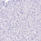 Immunohistochemical staining of human liver shows no positivity in hepatocytes as expected.