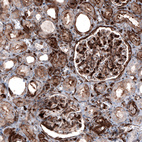 Immunohistochemical staining of human kidney shows moderate to strong cytoplasmic and membranous positivity in cells in glomeruli and in tubules.