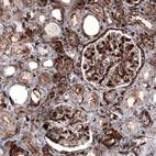 Immunohistochemical staining of human kidney shows moderate to strong cytoplasmic and membranous positivity in cells in glomeruli and in tubules.