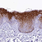 Immunohistochemical staining of human skin shows strong cytoplasmic positivity in epidermal cells.