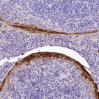 Immunohistochemical staining of human tonsil shows strong cytoplasmic positivity in squamous epithelial cells.