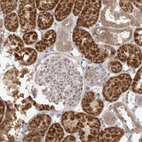 Immunohistochemical staining of human kidney shows strong cytoplasmic positivity in cells in tubules.
